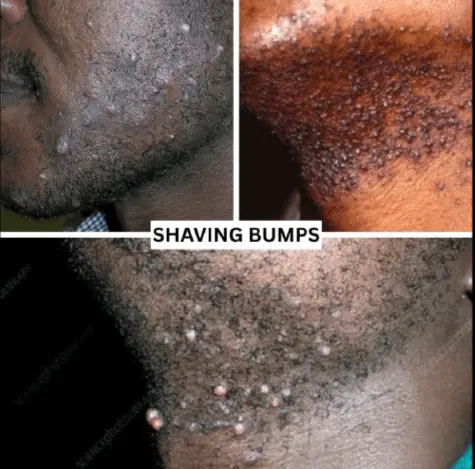 Dark marks and visible skin concern