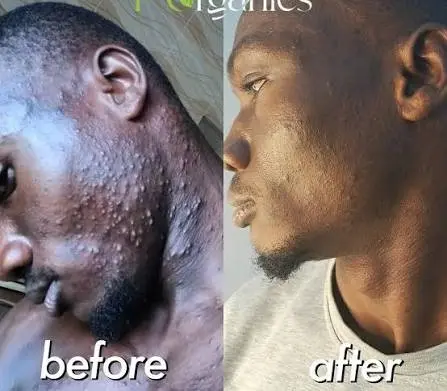 Before after
