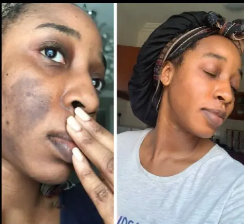 Customer before and after evidence