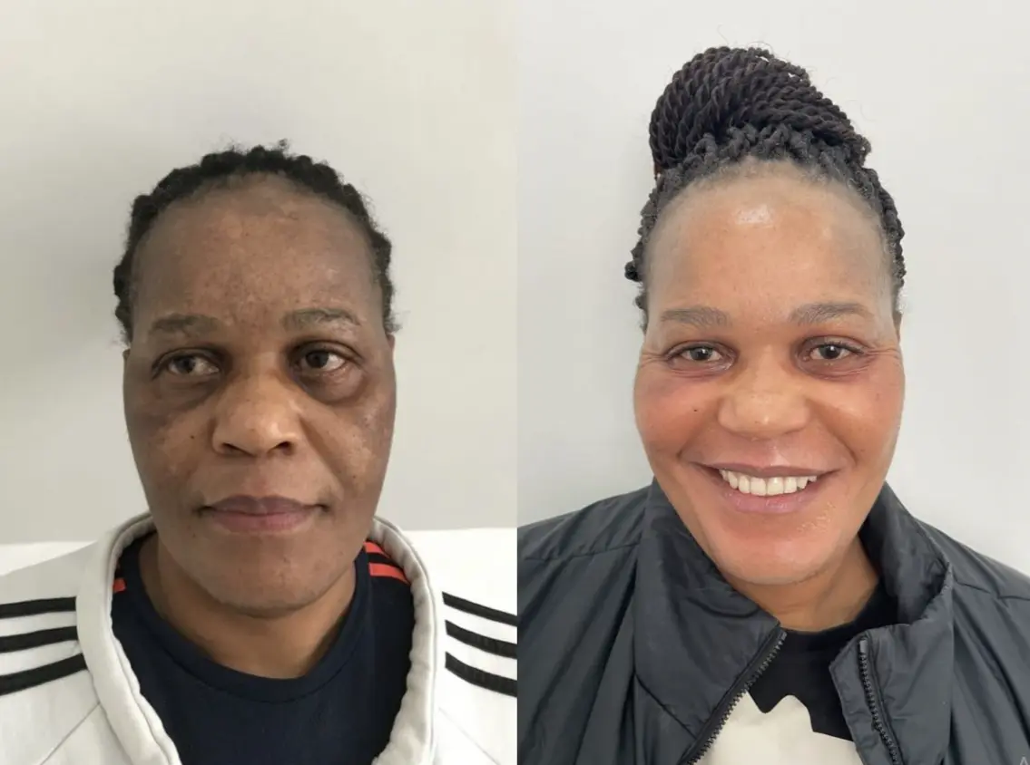Woman before and after