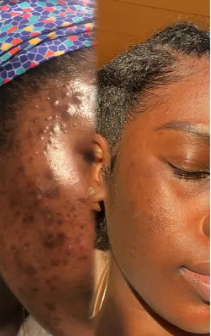 Customer before and after evidence