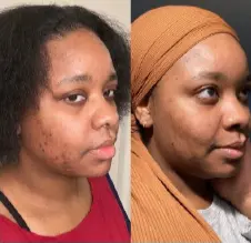 Customer before and after evidence