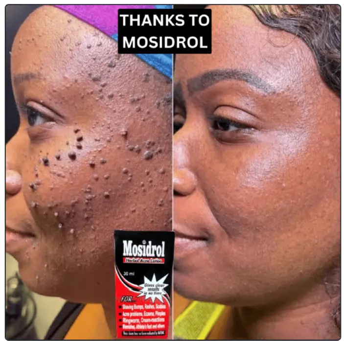 Female before after