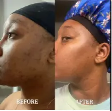 Customer before and after evidence