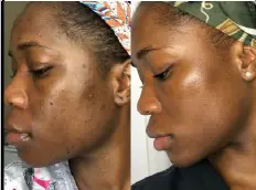 Customer before and after evidence